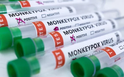 Health ministry releases dos and don’ts to prevent contracting monkeypox