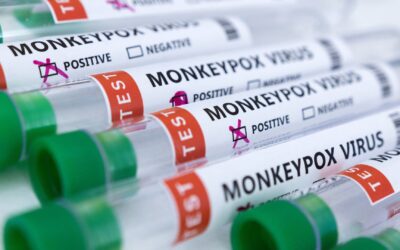 Monkeypox: How it spreads, who’s at risk – here’s what you need to know