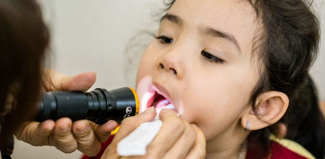 Oral health neglect affects nearly half the global population: WHO report