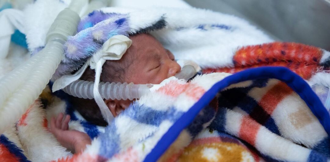 ‘Silent emergency’: Premature births claim a million lives yearly