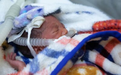 ‘Silent emergency’: Premature births claim a million lives yearly