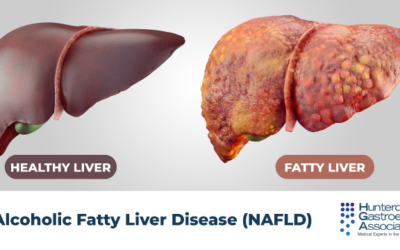 Rising liver ailments a concern; diet key to health and overall wellness: Experts